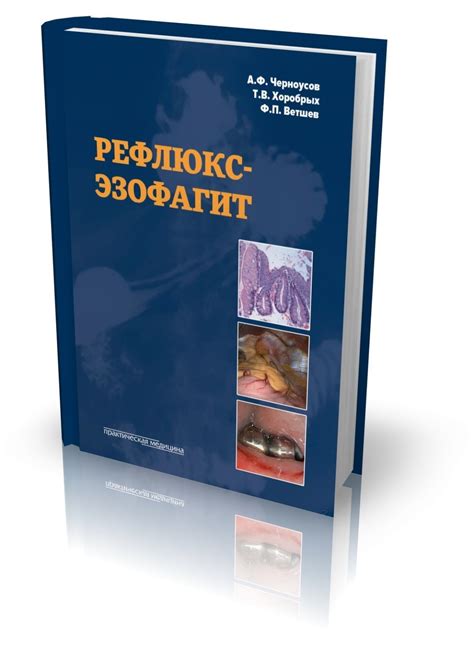 Рефлюкс-эзофагит