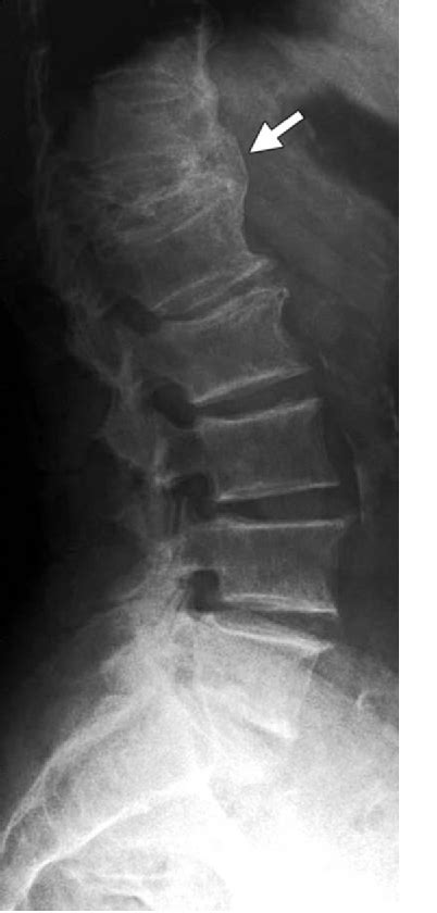 Figure 1 From Integrated Imaging Approach To Osteoporosis State Of The