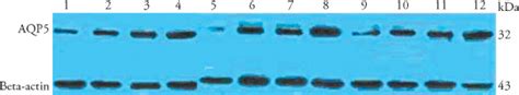 Western Blot Results Showing Expression Of Aquaporin Protein In Each