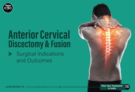 Anterior Cervical Discectomy And Fusion Indications And Outcomes