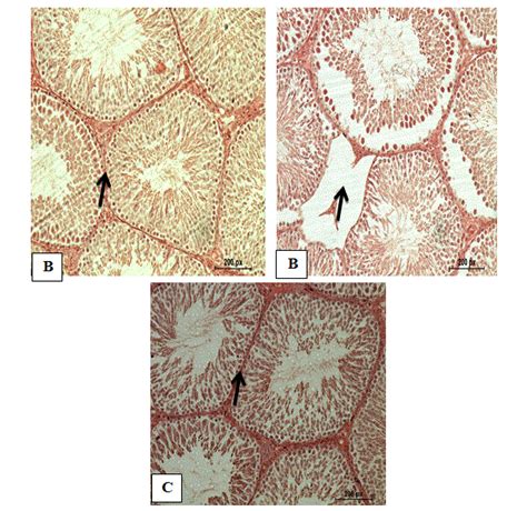 Normal Testicular Tissues With Normal Seminiferous Tubules Of The