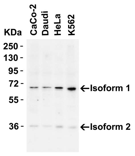 Anti Aif Ct Antibody Qed Bioscience Inc