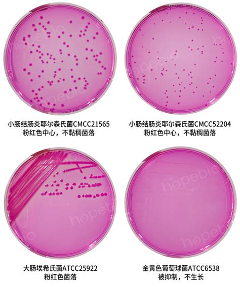 小肠结肠炎耶尔森氏菌——改良y培养基 微生物图片 青岛海博生物