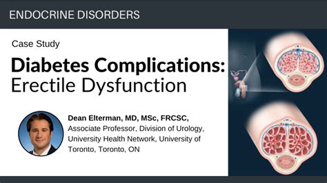 Diabetes Complications Erectile Dysfunction