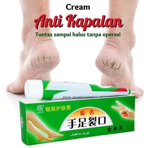 Obat Kaki Penghalus Kulit Rusak Salep Kaki Gatal Bernanah Salep Kaki