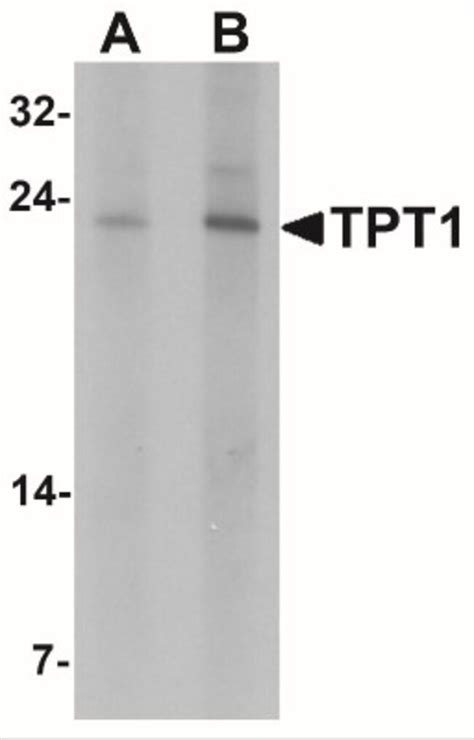 Tpt Tctp Antibody Bsa Free Novus Biologicals Mg Unlabeled