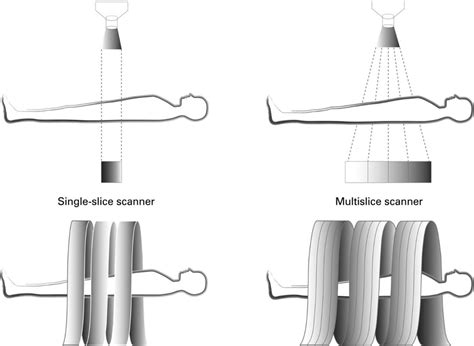 6 Single And Multi Slice Helical Ct Scan[32] Download Scientific Diagram