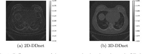 Figure 1 From A 3d Deep Learning Architecture For Denoising Low Dose Ct