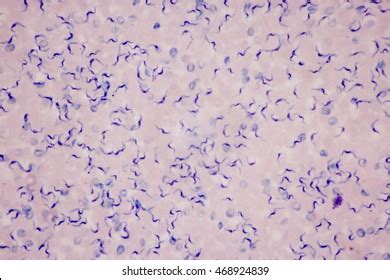 Trypanosoma Under Microscope