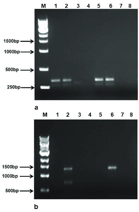 Agarose Gel Electrophoresis Lanes M Dna Ladder Marker Lanes 1 8 Download Scientific