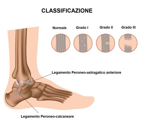 Osteopatia E Distorsione Di Caviglia Mattia Castrignano