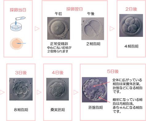 体外受精胚移植・顕微授精・凍結胚移植産婦人科ロイヤルハートクリニック新潟県新潟市