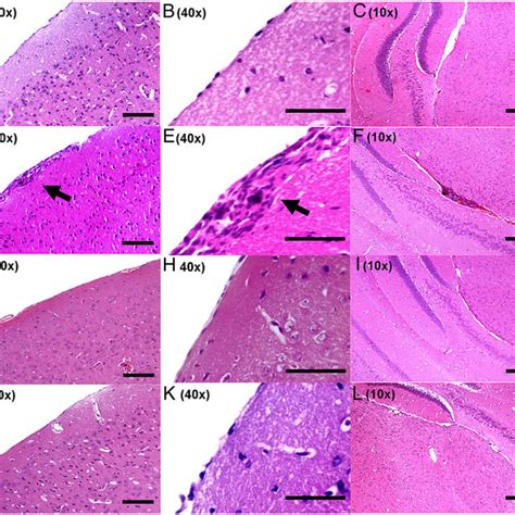 Clinical Score Of C57Bl 6 Mice Immunized With MOG 35 55 Peptide N 17