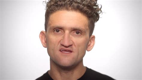 What Caused Casey Neistat Face To Look The Way It Does What Happened