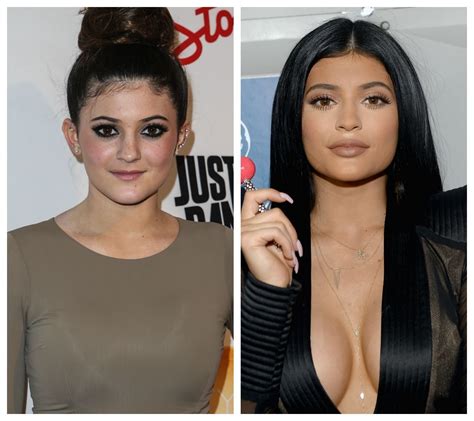 Plastic Surgery Bombshell Kylie Jenners Sisters Stage An Intervention Report In Touch