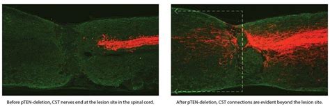 Redefining Spinal Cord Regeneration Research with Dr. Oswald Steward ...