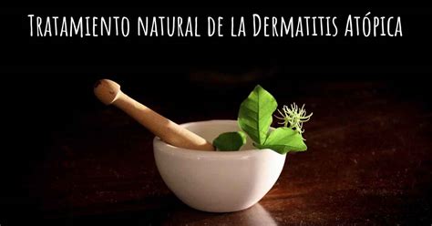 Existe Alg N Tratamiento Natural Para La Dermatitis At Pica