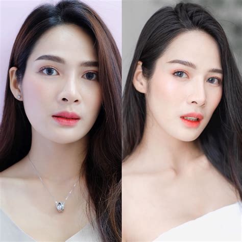 Botox Nabota Wrinkles Or Jawline Or Face Lift ริ้วรอย หรือ กราม หรือ ลิฟหน้า โบท็อกเกาหลียี้