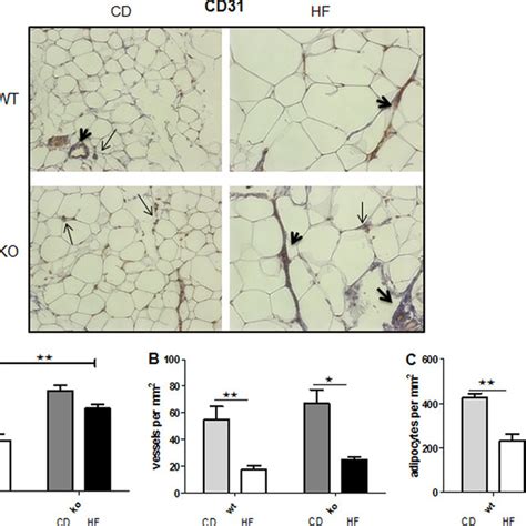 Attenuated Adipose Tissue Fibrosis In Hf 11hsd1 A Representative
