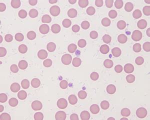 Mycoplasma Wenyonii EClinpath