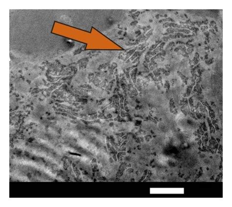 A Transverse Cut Of A Small Venule In The Hippocampal Area Of A Rat