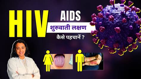 Hiv Symptoms In Men Women Aids Aur Hiv Ke Lakshan Kya Hote Hai