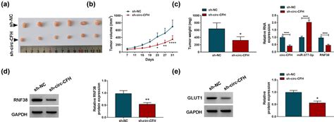 Circ Cfh Promotes The Development Of Hcc By Regulating Cell