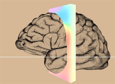 Entro 6 mesi un chip Neuralink verrà impiantato nel cervello umano