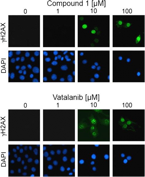 Immunofluorescence Of Mcf 7 Cell Lines Immunofluorescence Of Mcf 7 Download Scientific Diagram