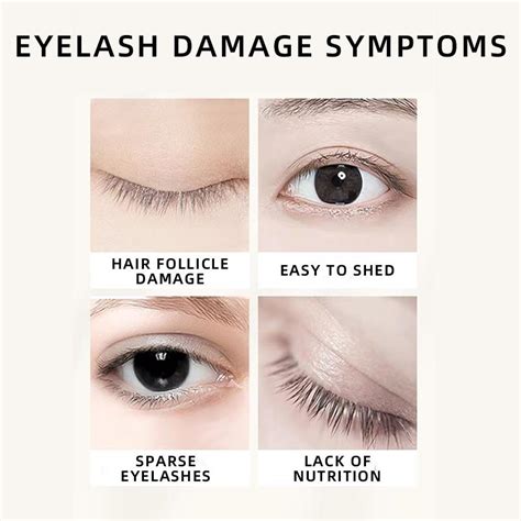 Cheap Eyelash Growth Products Eyelashes Growth Enhancer Nourishing