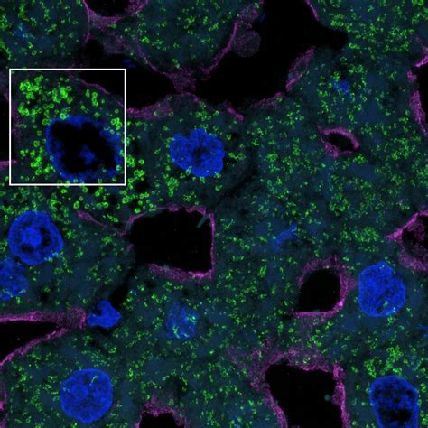 Ax Ax R With Nsparc Ax Ax R With Nsparc Confocal And