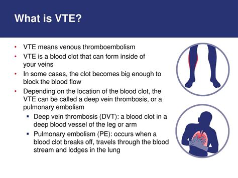 Understanding Your Risk For Developing Blood Clots Vte In Cancer