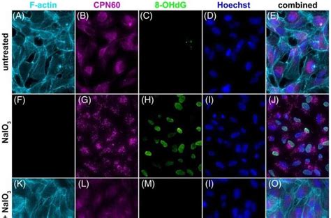 New Gene Therapy Shows Promise For Treating Age Related Macular Degeneration Regenerative