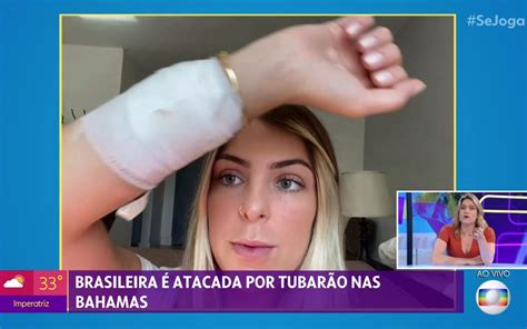 Influenciadora fala sobre mordida de tubarão nas Bahamas Se Joga Gshow