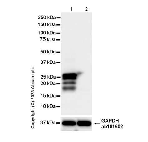 Recombinant Anti Cardiac Troponin I Antibody RM1073 Ab314912 Abcam