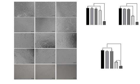 Tube Formation Assays In Vitro A HemSCs Treated With Endothelial