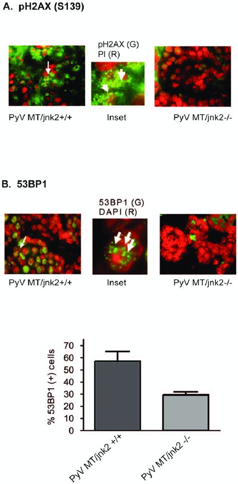 Ph2ax And 53bp1 Staining In Pyv Mt Tumors A Paraffin Embedded Pyv Mt Download Scientific