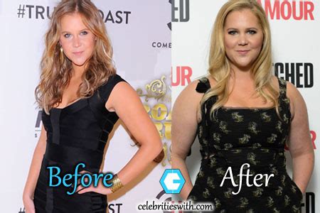 Amy Schumer Weight Gain, Plastic Surgery, Before and After Pictures ...