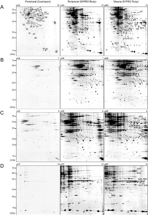 Figure From Comparative Proteomic Analyses Of Macular And Peripheral