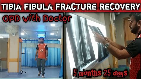 Tibia Fibula Fracture Recovery My Journey Skin Grafting Today 5 Months