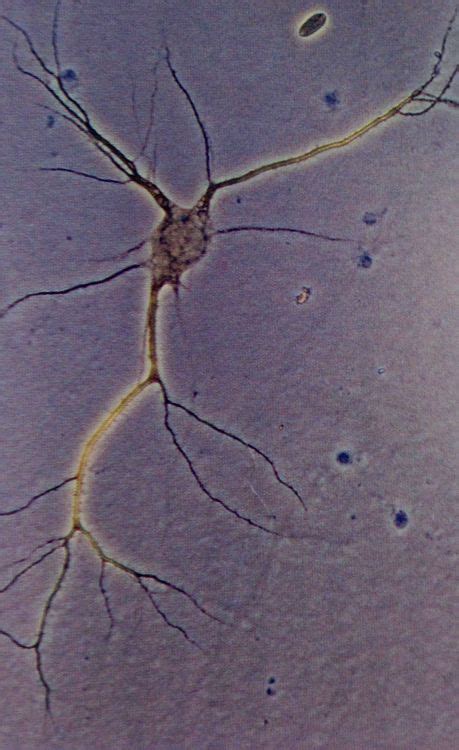 Nerve Cell Microscope Slide