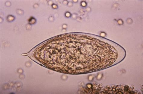 Schistosoma Japonicum Detailed Information Photos Videos