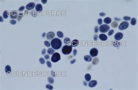 Lm Of Saccharomyces Cerevisiae Stock Image Science Source Images