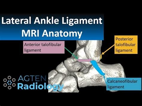 Ankle Anatomy Mri - Anatomical Charts & Posters