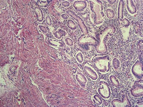 Endometrium Anatomy Function And Related Conditions