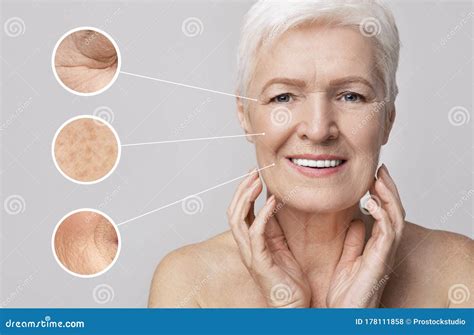 Beautiful Senior Woman Portrait With Zoomed Zones With Skin Aging Signs