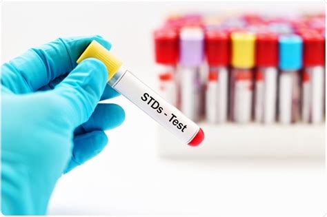 Nyc Std And Sti Testing Services Great City Medical