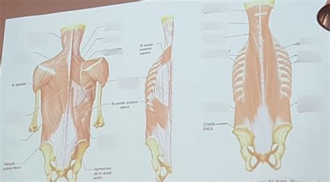 Diagrama de Vista posterior de los músculos del dorso 1 Quizlet