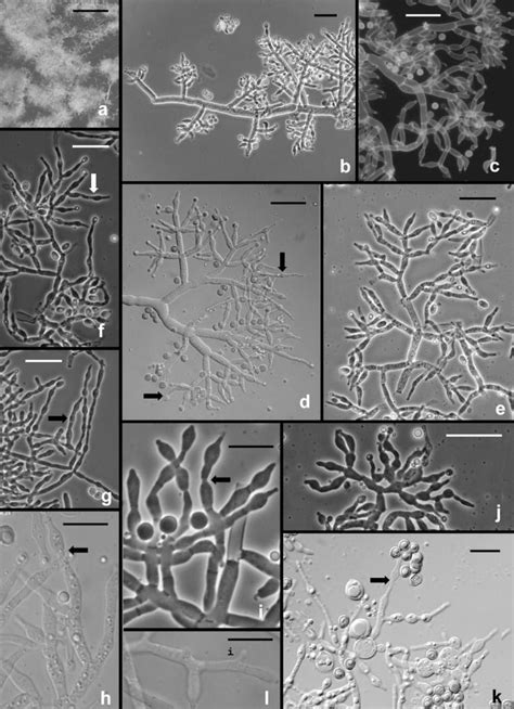 Hypocrea Trichoderma Viridescens Anamorph From CMD A Pustule Bk