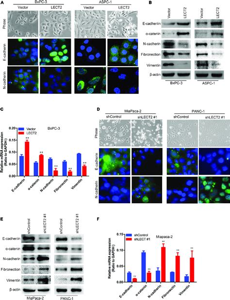 Lect Inhibits Epithelial Mesenchymal Transition Emt In Pdac A